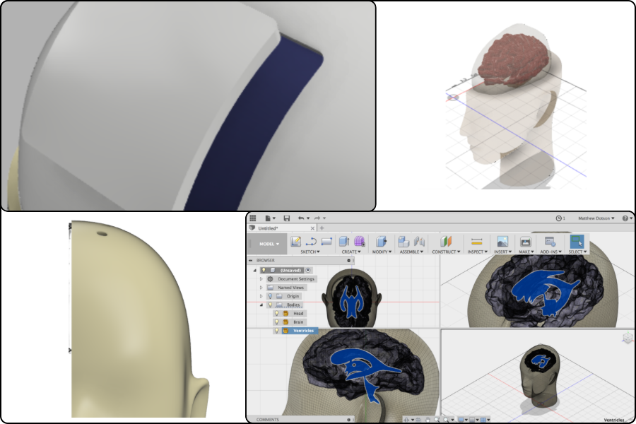 Brain catheter simulation model