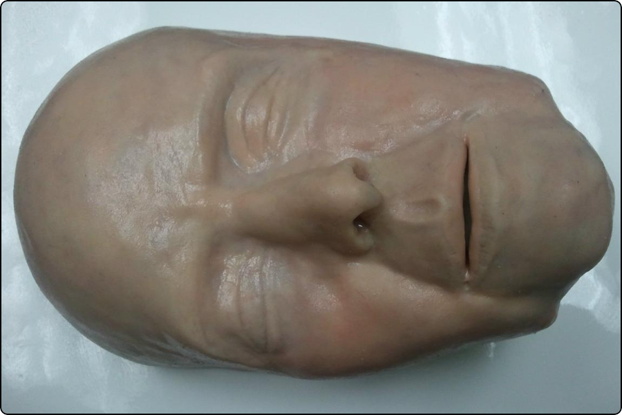 Medical simulation head model, filler injection training