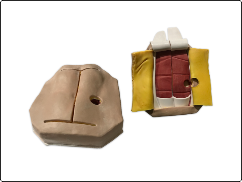 Abdominal Mesh Model