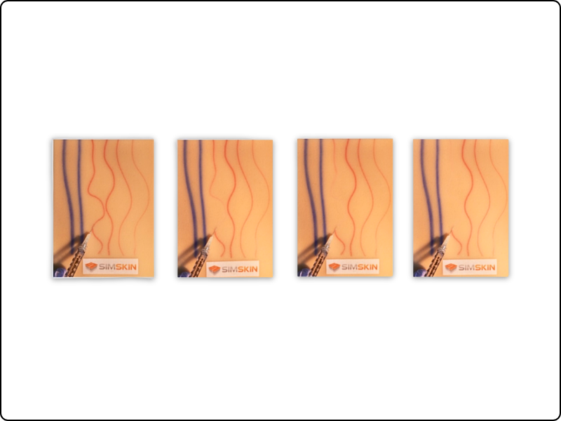 Sclerotherapy Pad