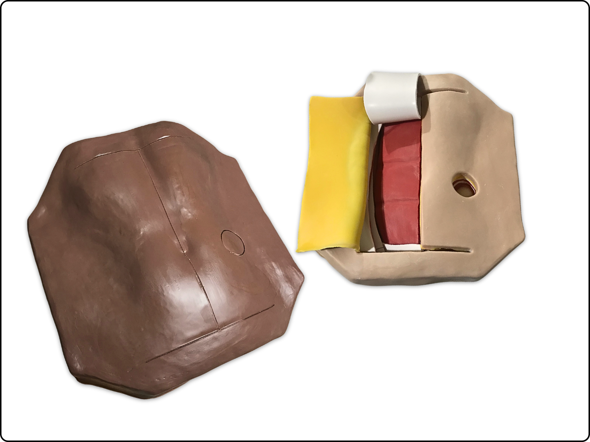 Abdominal Mesh Model image 3