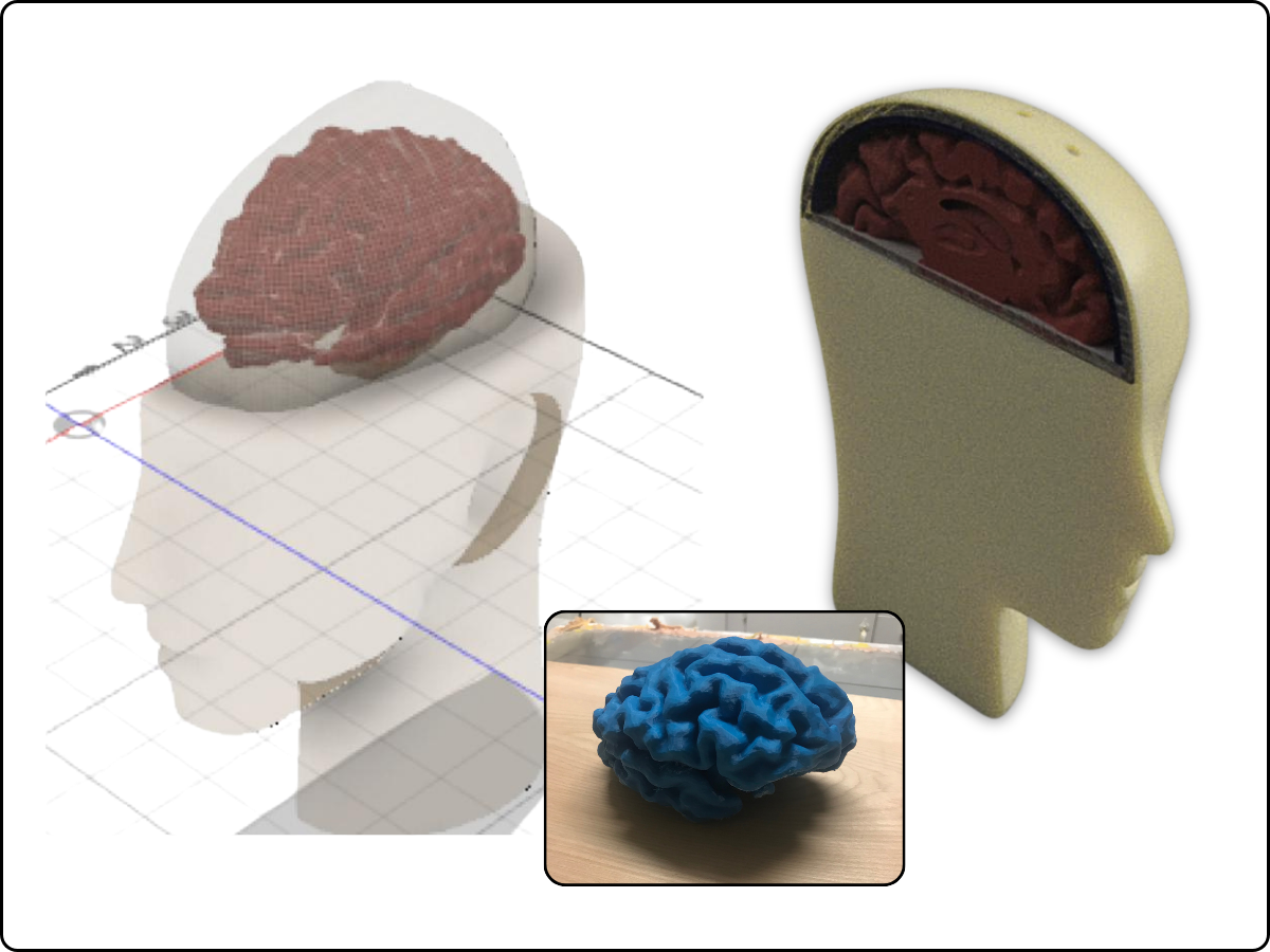 Brain Catheter Model image 1